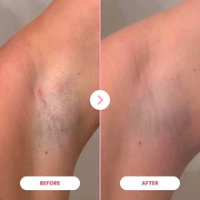 Lade das Bild in den Galerie-Viewer, EpiLuxe