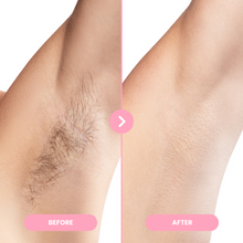 Lade das Bild in den Galerie-Viewer, 1x EpiLuxe