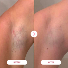 Lade das Bild in den Galerie-Viewer, 1x EpiLuxe